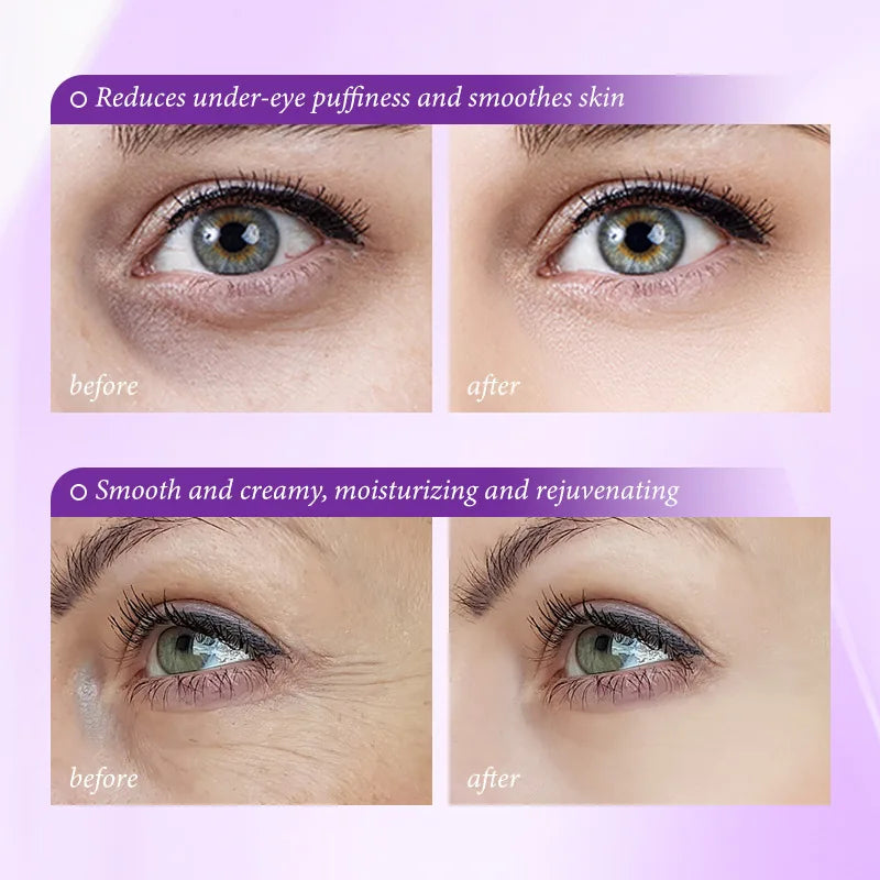 Pro-xylane Eye Cream Anti-wrinkle Anti-Puffiness Eliminate Dark Circles Firming Deep Moisturizing Eye Beauty Korean Skin Care