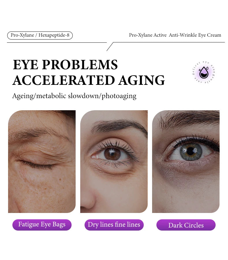 Pro-xylane Eye Cream Anti-wrinkle Anti-Puffiness Eliminate Dark Circles Firming Deep Moisturizing Eye Beauty Korean Skin Care