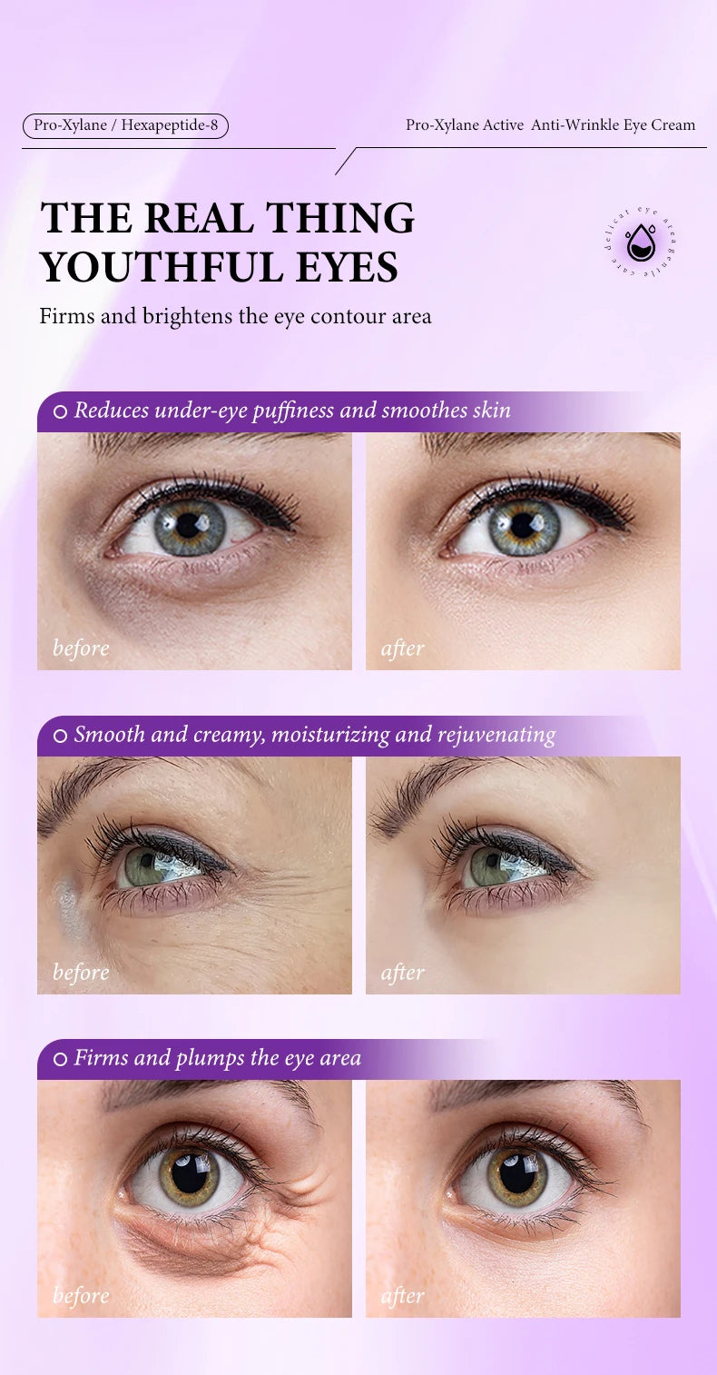 Pro-xylane Eye Cream Anti-wrinkle Anti-Puffiness Eliminate Dark Circles Firming Deep Moisturizing Eye Beauty Korean Skin Care